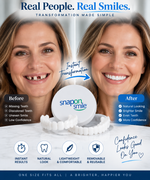 Snap-On Smile Dental Veneers | Removable Artificial Teeth for Instant Smile Enhancement